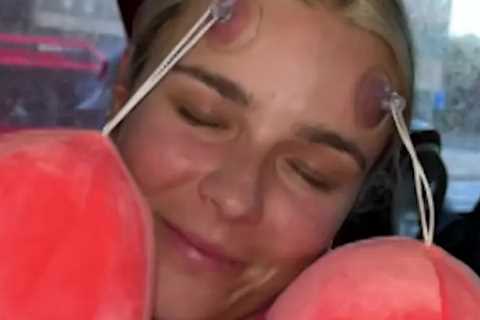 BBC Pundit and Ex-England Cricketer's Retirement Party Prank Goes Wrong, Leaving Her with Huge Bruises on Her Face